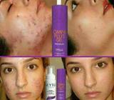 Tienes Problemas de Acné Espinillas