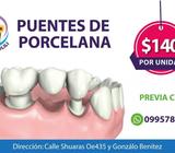 PUENTES DE PORCELANA DESDE $140
