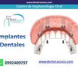 Protesis Dental con Implantes Dentales