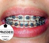 Brackets Promoción Ortodoncia