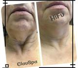 Hifu Papada