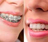 Brackets sin Entrada por Solo 30