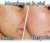 Skin Glow Piel de Porcelana